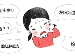 过敏性皮炎注意事项【惠州广肤治疗皮肤过敏怎么样】