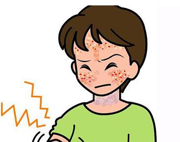 过敏性皮炎反复发作怎么办【惠州广肤皮肤病专科】